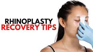 Rhinoplasty Recovery Tips | Advice from LA Plastic Surgeons