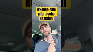 🚨 ALLERGISCHE REAKTION - so erkennst du sie