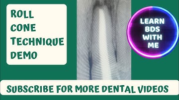 Roll cone technique obturation demo🥢