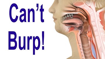 Inability to Burp: Retrograde Cricopharyngeus Dysfunction (R-CPD)