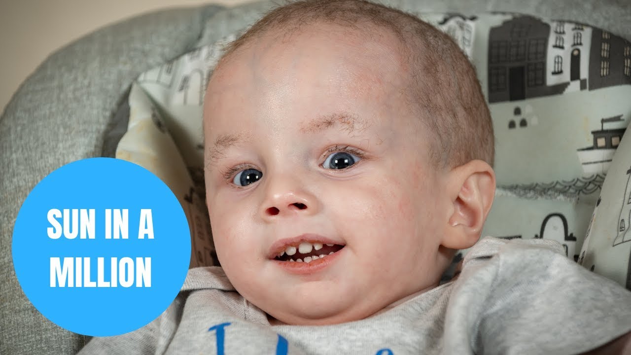 life facebook Toddler will spend life in darkness because he is allergic to sunlight