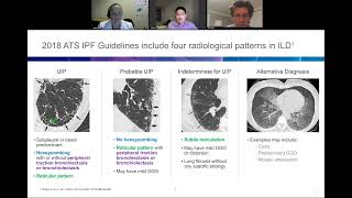 Exclusive HRCT pattern in ILD Profile