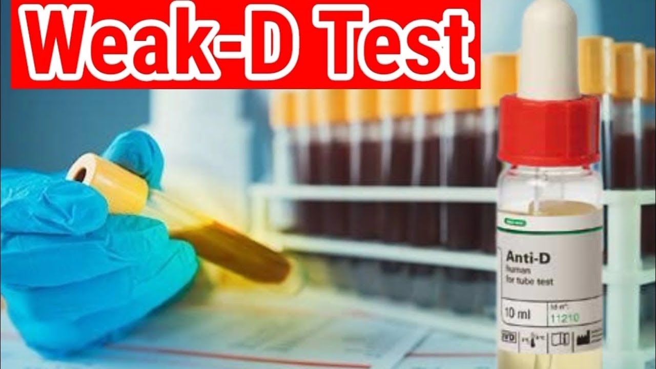 Weak-D Testing (Weak Reaction of Rh-D) - YouTube