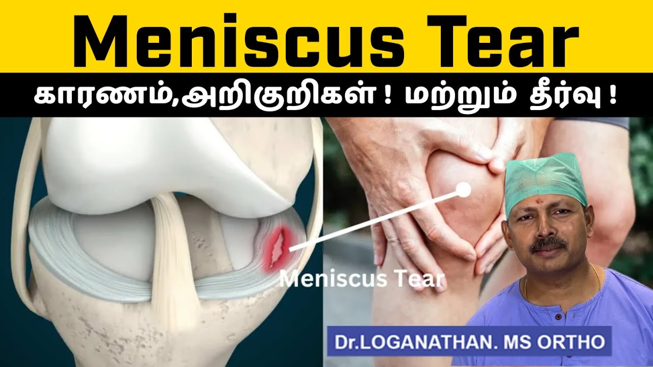 Meniscus Tear Explained 🦵 | Causes, Symptoms & Surgery Options ⚕️ | Knee Pain Relief Tips 💥
