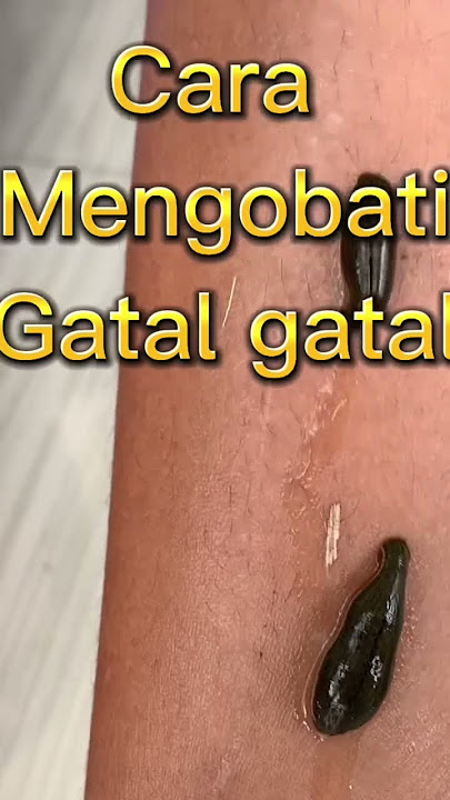 Cara mengobati gatal gatal#viralshorts #pengobatanalternatif #lintah