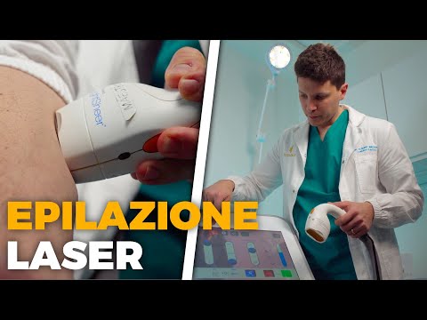 Epilazione Laser: Come funziona e quanto dura? | Dott. Claudio Maestrini