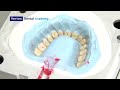 Vertex Dental ThermoSens