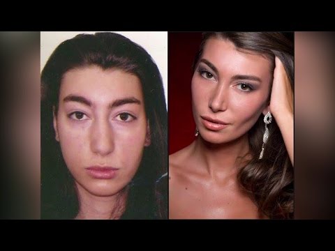 ქართველი ლამაზმანები, რომლებიც საკუთარ სილამაზეს პლასტიკურ ქირურგიას უნდა უმადლოდნენ