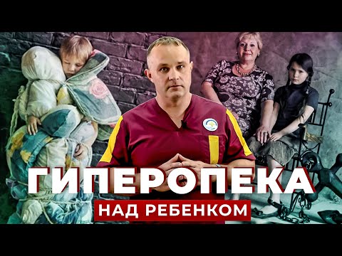 ГИПЕРОПЕКА | Как гиперопека влияет на ребенка | Ошибки родителей в воспитании детей