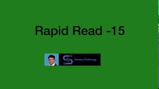 Rapid read - 15