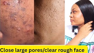 How to clear rough face and textured skin | Simple skincare Routine for clear and smooth face  #acne