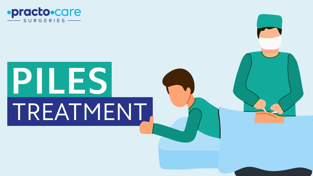 Piles Treatment [In Hindi] Piles (बवासीर) and Laser Surgery Practo