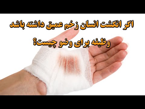 اگر انگشت انسان زخم عمیق داشته باشد وظیفه برای وضو چیست