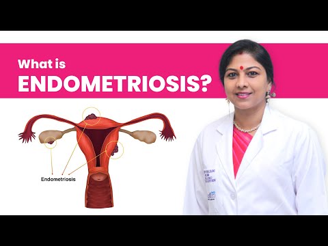 Endometriosis | What is Endometriosis? | Best Gynaecologist in Hyderabad | Dr. K. Shilpi Reddy