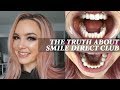 The Truth About Smile Direct Club | Treatment Plan & Review | My Experience