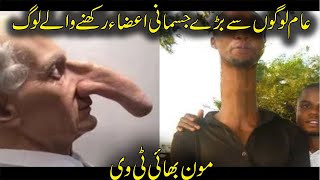 20 People With Bigger Than Normal Body Parts | hindi\/urdu | Moon Bhai TV |