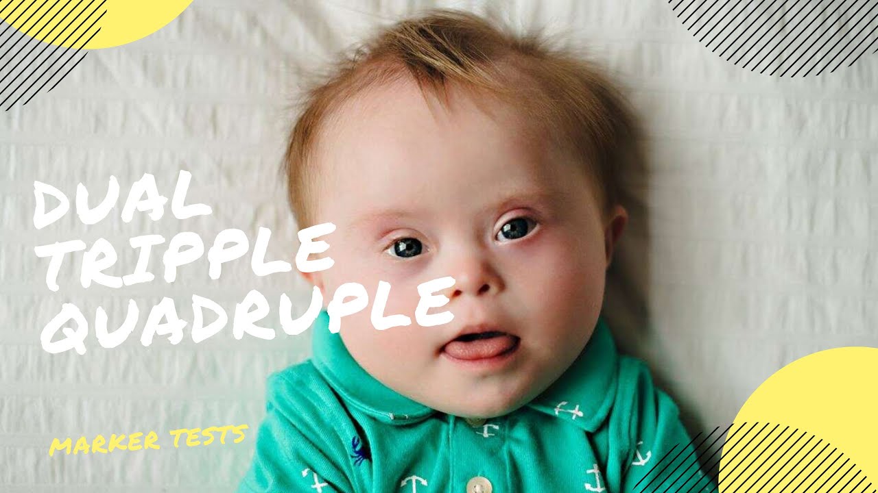 Dual Tripple Quadrupal Marker Tests Screening Tests For Down Syndrome During Pregnancy YouTube
