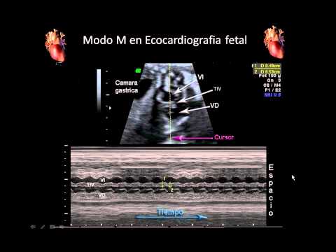 Vídeo: Com Escoltar Un Batec Del Cor Fetal