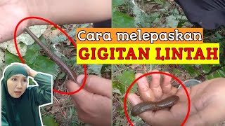 Tips melepaskan Gigitan LINTAH || cara melepaskan gigitan lintah