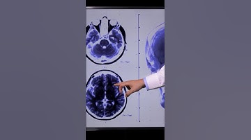 Download Knowledge in Human Brain