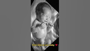 The Miracle of Life in the Womb❤💖 #shorts  #miracleinmotion #baby