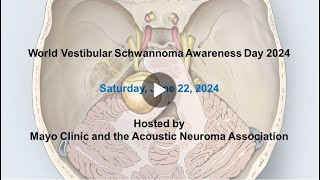 Cochlear implantation after treatment for vestibular schwannoma