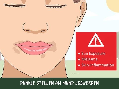 Video: Den Magen eines Hundes reiben – wikiHow