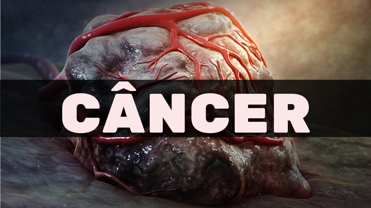 Câncer e carcinogênese   Fisiologia Humana