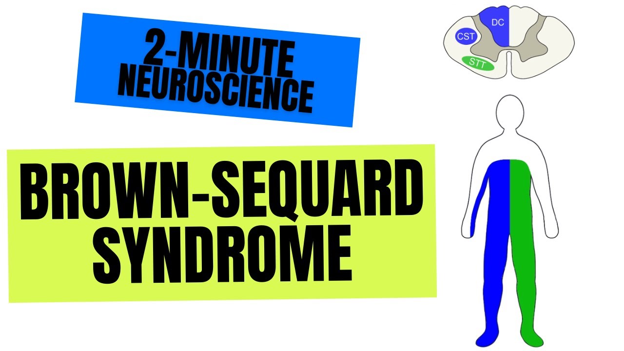 2-Minute Neuroscience: Brown-Séquard Syndrome