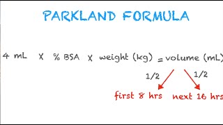 Parkland Formula Made Easy