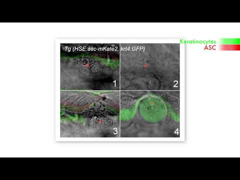 biosights: September 4 2017 - A new aspect on ASC specks