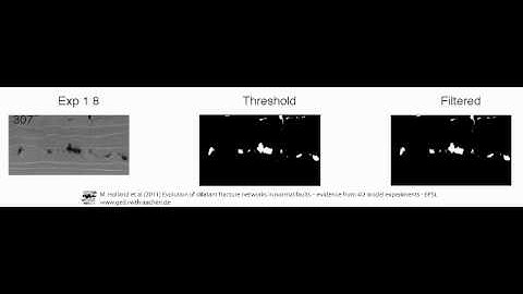 Studying open fractures in CT-scanner - Segmenting the results 1