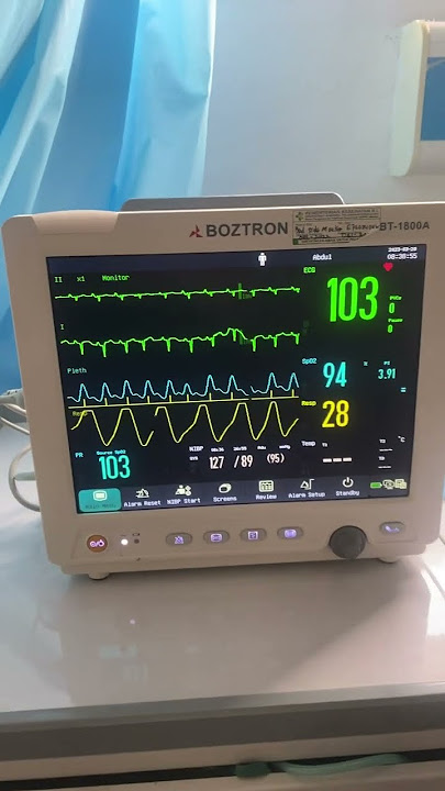 Monitor ICCU pasien serangan Jantung (STEMI) #stemi
