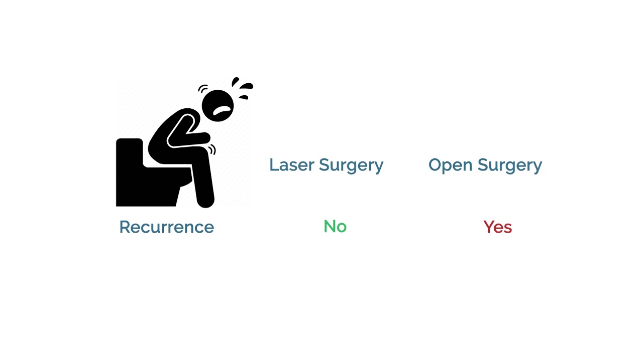Laser Surgery for Anal Fissure | Open Surgery vs Laser Surgery