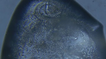 Nematodes Under the Microscope