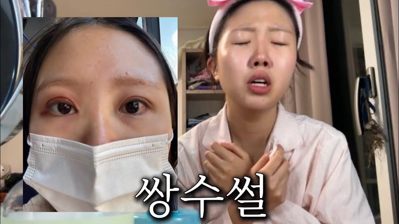 여러분 저 사실 성형했어요