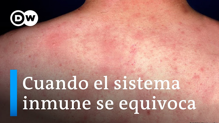 La alergia: un error del sistema de defensa del organismo
