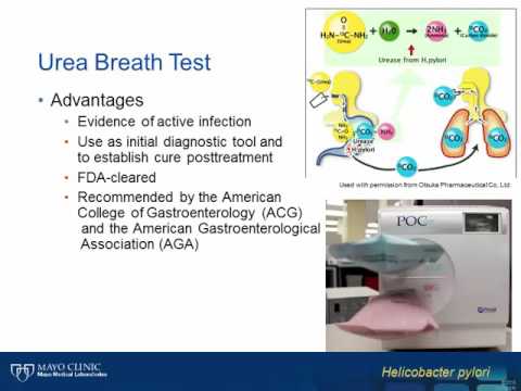 Endoscopy H Pylori Test