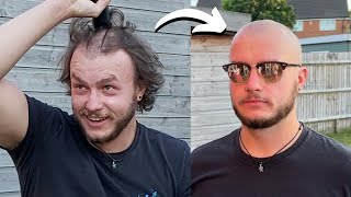 BALDING Man Shaves Head And Embraces The BALD LOOK *Transformation*