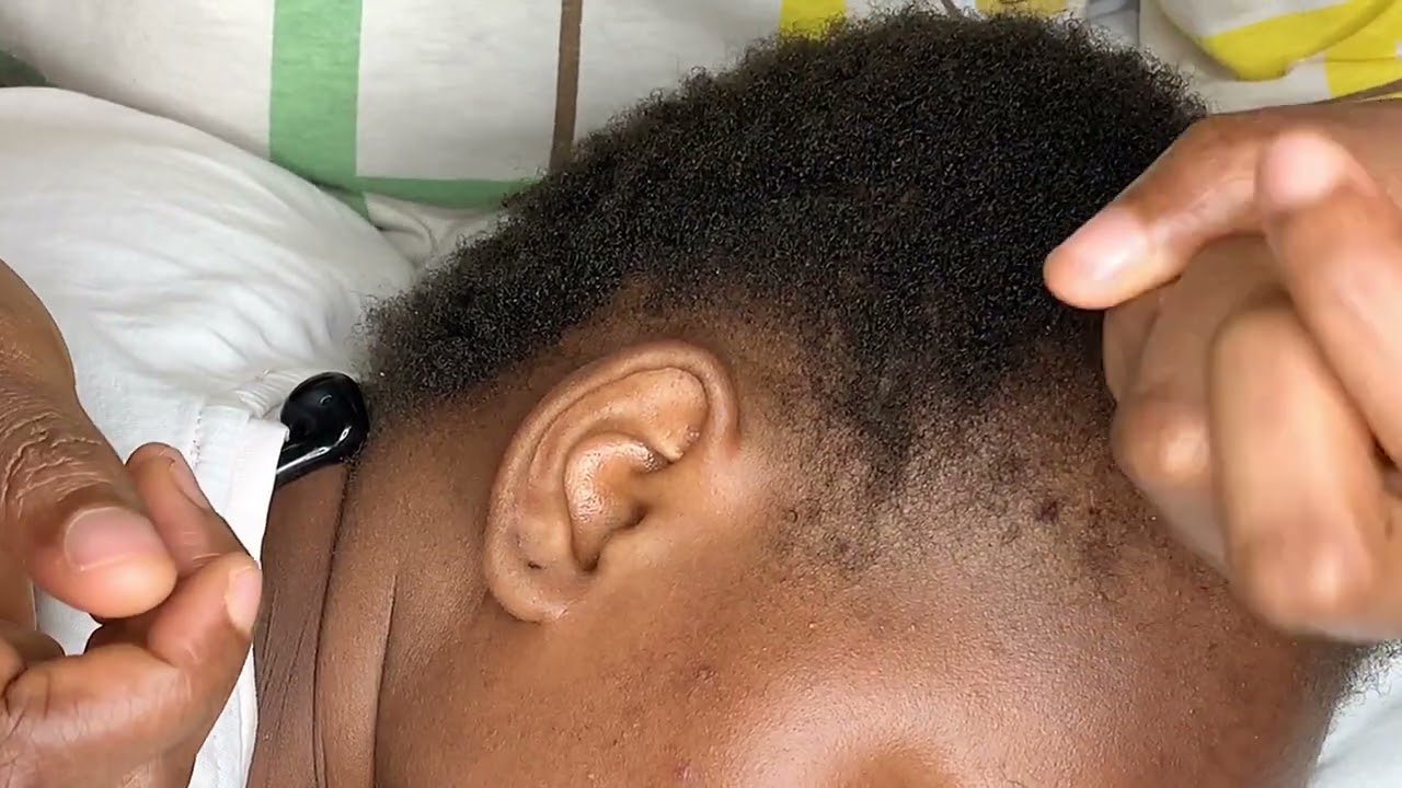 ASMR EAR CLEANING WITH BUBBLEGUM 💤