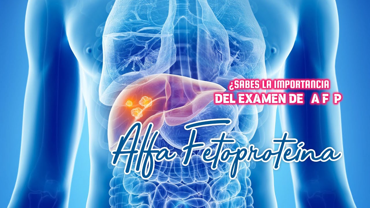 Examen AFP Alfa Fetoproteína: Detección Temprana de Cáncer | DayerLab ...