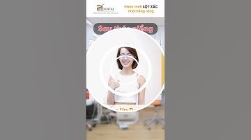 Hành trình LỘT XÁC nhờ niềng răng của Kỳ Duyên