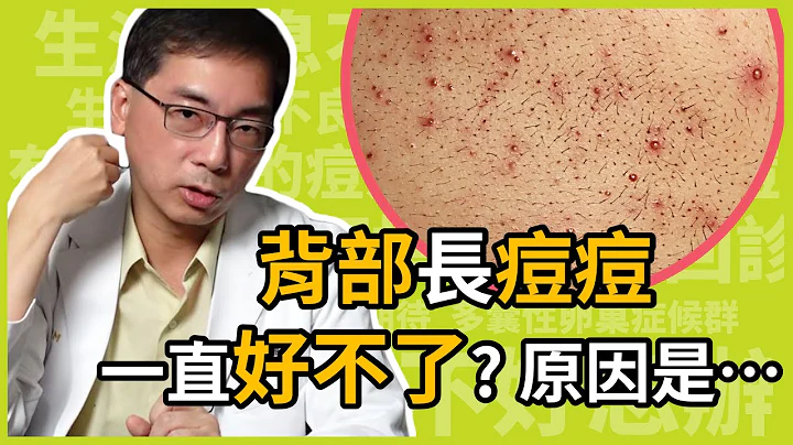 為什麼背部長痘痘，會一直治不好？怎麼治療才不會色素沉澱？治療背部痘痘的關鍵原因，醫美里長一次告訴你！ - 天天要聞