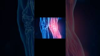 Joints Pain hmesha ke liye khatam #jointpain #dardkailaj #jointspainflp #flpproducts #shorts #short