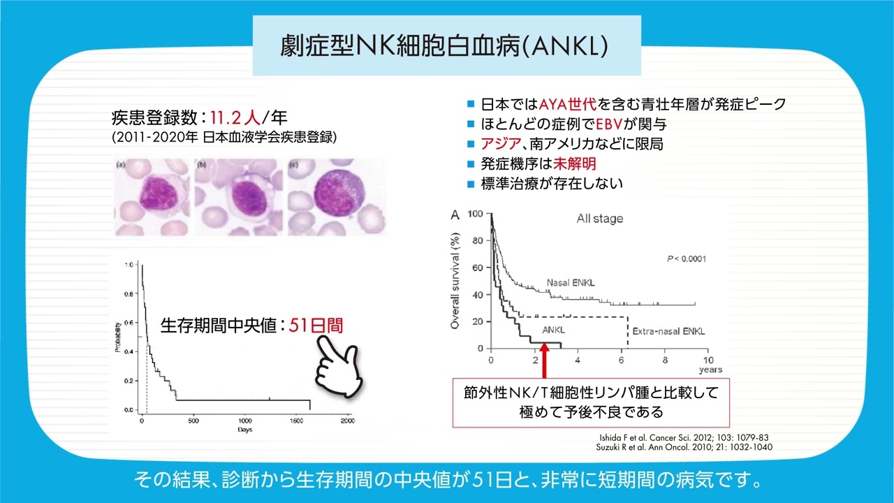 【本番用】アグレッシブNK細胞白血病(ANKL)患者を対象とした医師主導治験のご案内