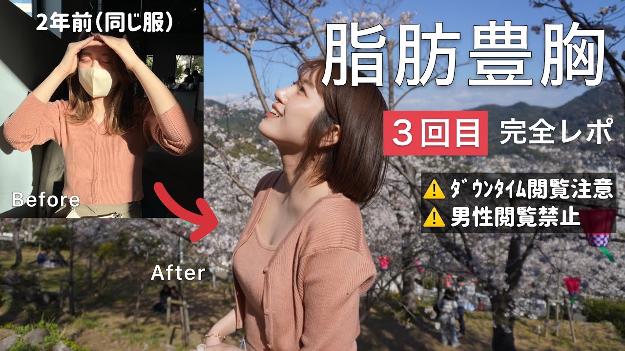 【脂肪豊胸】３回目を受けてきたので施術前日からダウンタイムの様子をリアルレポ‼️閲覧注意⚠️