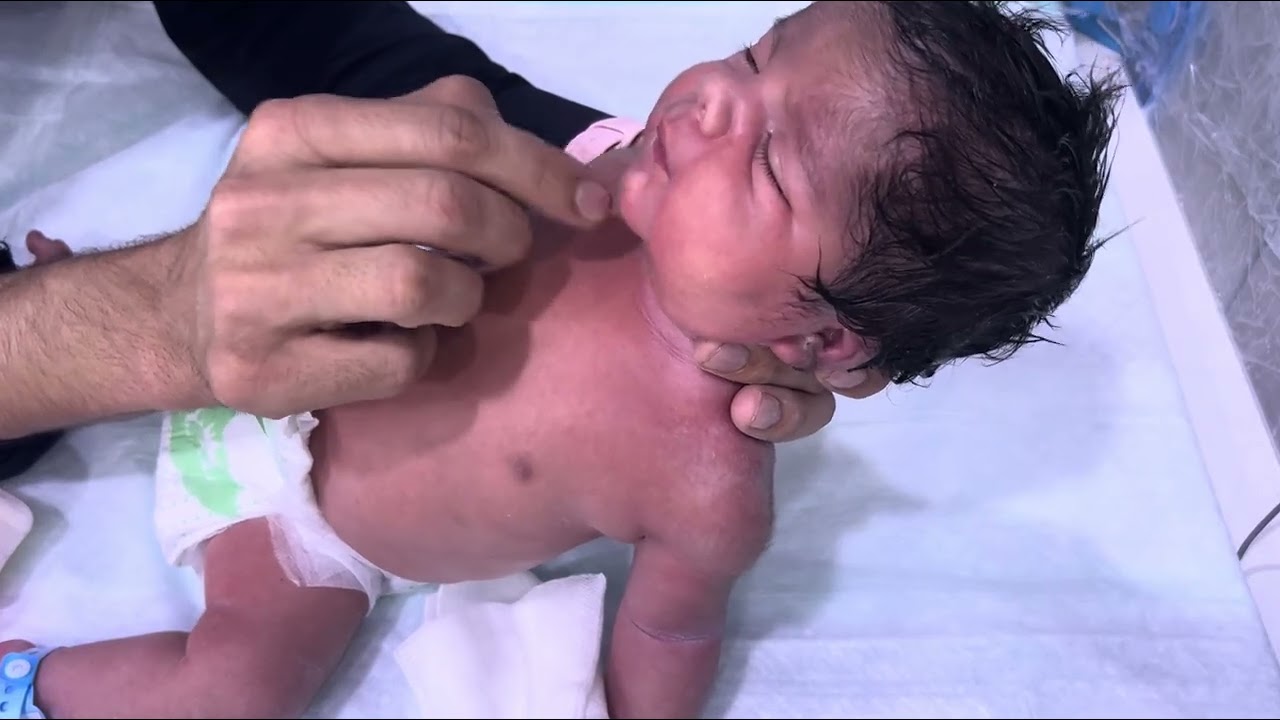 Newborn IDM Baby inGood Condition Feeding Well NICU Progress Update
