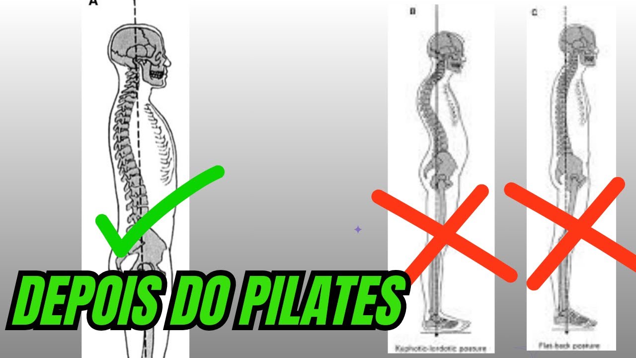 Melhore sua postura com pilates!