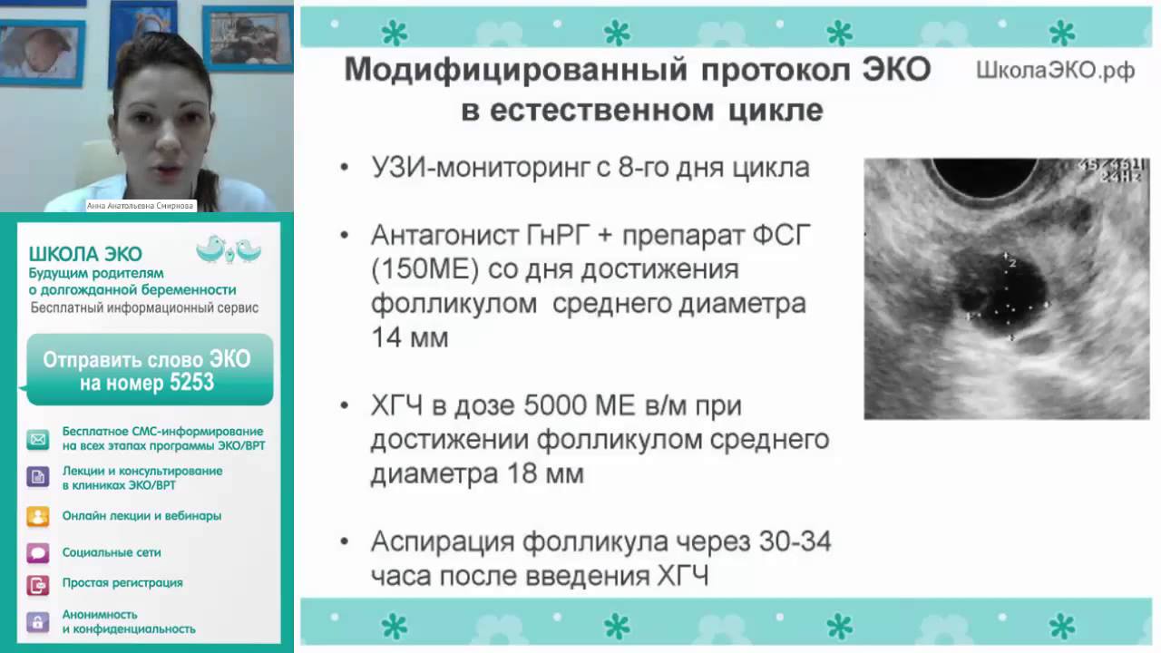 Эко форум у кого получилось. Протокол эко в естественном цикле. Модифицированный ец протокол эко. Эко в естественном цикле по дням. Естественное эко.