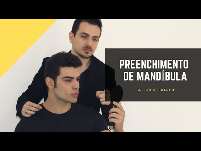 Preenchimento de Mandíbula - Dra. Camila Calazans